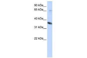 ST6GALNAC1 antibody used at 1 ug/ml to detect target protein. (ST6GALNAC1 antibody)