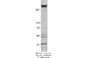 Image no. 1 for anti-E1A Binding Protein P300 (EP300) (AA 1572-2371) antibody (ABIN363280) (p300 antibody  (AA 1572-2371))