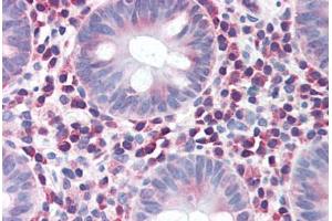 Human Colon (formalin-fixed, paraffin-embedded) stained with IRGM antibody ABIN351455 at 5 ug/ml followed by biotinylated goat anti-rabbit IgG secondary antibody ABIN481713, alkaline phosphatase-streptavidin and chromogen. (IRGM antibody  (Internal Region))