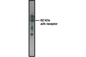 Western blot analysis using alpha2B adrenergic receptor antibody on  MDCK cells transfected to produce alpha2B receptor protein.