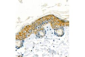 Immunohistochemistry of paraffin embedded rat skin using CK13 (ABIN7074411) at dilution of 1:1200 (400x lens)