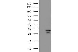 HEK293T cells were transfected with the pCMV6-ENTRY control (Left lane) or pCMV6-ENTRY CAMLG (Right lane) cDNA for 48 hrs and lysed. (CAMLG antibody)