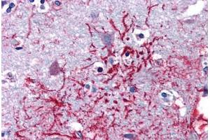 Human Brain, Cortex (formalin-fixed, paraffin-embedded) stained with DHX58 antibody ABIN351452 at 5 ug/ml followed by biotinylated goat anti-rabbit IgG secondary antibody ABIN481713, alkaline phosphatase-streptavidin and chromogen. (DHX58 antibody  (Internal Region))