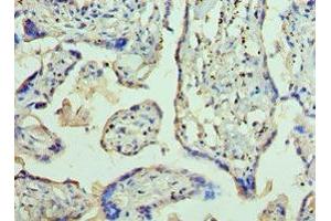 Immunohistochemistry of paraffin-embedded human placenta tissue using ABIN7144363 at dilution of 1:100 (AP2B1 antibody  (AA 738-937))