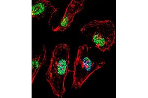 Fluorescent confocal image of Hela cell stained with TBX6 Antibody (Center) (ABIN656001 and ABIN2845380).