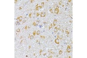 Immunohistochemistry of paraffin-embedded mouse brain using EIF2B2 antibody (ABIN6132131, ABIN6140037, ABIN6140038 and ABIN6222805) at dilution of 1:100 (40x lens).