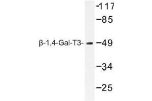 Image no. 1 for anti-UDP-Gal:betaGlcNAc beta 1,4- Galactosyltransferase, Polypeptide 3 (B4GALT3) antibody (ABIN317820) (B4GALT3 antibody)