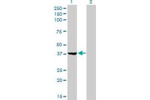 Western Blot analysis of EIF2B2 expression in transfected 293T cell line by EIF2B2 monoclonal antibody (M01), clone 5B12-E10.