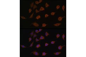 Immunofluorescence analysis of L929 cells using LSM1 antibody (ABIN6131868, ABIN6143353, ABIN6143354 and ABIN6216476) at dilution of 1:100. (LSM1 antibody  (AA 1-133))