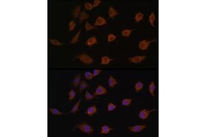 Immunofluorescence analysis of L929 cells using LSM1 antibody (ABIN6131868, ABIN6143353, ABIN6143354 and ABIN6216476) at dilution of 1:100. (LSM1 antibody  (AA 1-133))
