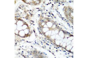 Immunohistochemistry of paraffin-embedded human colon using NAA60 antibody at dilution of 1:200 (40x lens). (NAT15 antibody)