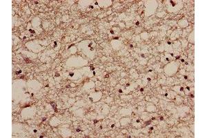 Immunohistochemistry of paraffin-embedded human brain tissue using ABIN7168220 at dilution of 1:100