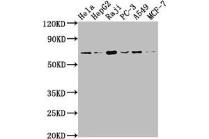 Western Blot Positive WB detected in: Hela whole cell lysate, HepG2 whole cell lysate, Raji whole cell lysate, PC-3 whole cell lysate, A549 whole cell lysate, MCF-7 whole cell lysate All lanes: ALAS1 antibody at 1:1500 Secondary Goat polyclonal to rabbit IgG at 1/50000 dilution Predicted band size: 71, 13 kDa Observed band size: 71 kDa (Recombinant ALAS1 antibody)