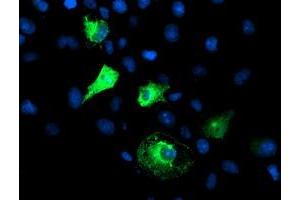Anti-FBXO21 mouse monoclonal antibody (ABIN2455367) immunofluorescent staining of COS7 cells transiently transfected by pCMV6-ENTRY FBXO21 (RC223095). (FBXO21 antibody)
