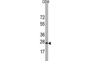 Western Blotting (WB) image for anti-BARX Homeobox 1 (BARX1) antibody (ABIN3003108) (BARX1 antibody)