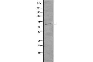 Western blot analysis of CTPS using K562 whole cell lysates (CTP Synthase antibody  (C-Term))