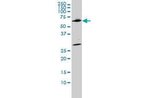 WDR20 monoclonal antibody (M02), clone 2A6 Western Blot analysis of WDR20 expression in Hela S3 NE .