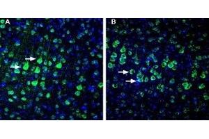 Expression of NETO1 in rat and mouse cortex. (NETO1 antibody  (Extracellular))