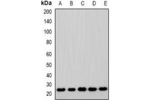 Western blot analysis of ASF1A expression in Jurkat (A), A549 (B), MCF7 (C), mouse lung (D), rat lung (E) whole cell lysates. (ASF1A antibody)