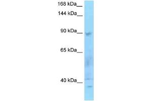WB Suggested Anti-SECISBP2 Antibody Titration: 1. (SECISBP2 antibody  (N-Term))