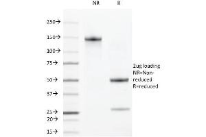 SDS-PAGE Analysis Purified VEGFR2 Rat Monoclonal Antibody (DC101). (VEGFR2/CD309 antibody)