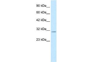 WB Suggested Anti-KCNIP4 Antibody Titration:  0. (KCNIP4 antibody  (N-Term))