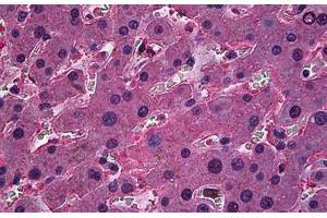 Human Liver: Formalin-Fixed, Paraffin-Embedded (FFPE) (ORM1 antibody  (AA 18-202))