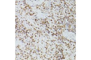 Immunohistochemistry of paraffin-embedded rat spleen using G antibody (ABIN6133721, ABIN6140975, ABIN6140976 and ABIN6217864) at dilution of 1:150 (40x lens). (GATA4 antibody  (AA 50-150))