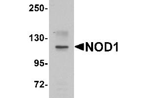 Western blot analysis of NOD1 in EL4 cell lysate with NOD1 antibody at 1 µg/mL. (NOD1 antibody  (C-Term))
