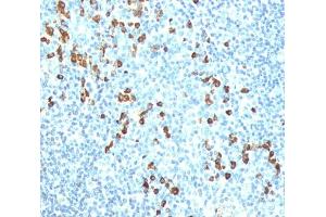 IHC testing of human tonsil stained with anti-IgM antibody (IM260). (Mouse anti-Human IgM Antibody)