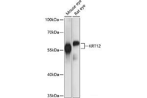 Western blot analysis of extracts of various cell lines using KRT12 Polyclonal Antibody at dilution of 1:1000. (KRT12 antibody)
