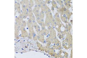 Immunohistochemistry of paraffin-embedded human liver injury using NSF antibody at dilution of 1:100 (x40 lens). (NSF antibody)