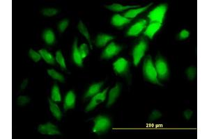 Immunofluorescence of monoclonal antibody to WDR5 on HeLa cell. (WDR5 antibody  (AA 16-120))