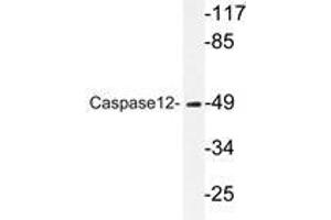 Western blot analysis of Caspase12 antibody in extracts from HUVEC cells. (Caspase 12 antibody)