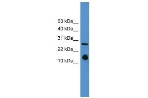 Western Blot showing Il5 antibody used at a concentration of 1-2 ug/ml to detect its target protein. (IL-5 antibody  (Middle Region))