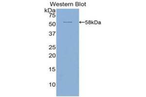 Western Blotting (WB) image for anti-Activated Leukocyte Cell Adhesion Molecule (ALCAM) (AA 28-527) antibody (ABIN3201204) (CD166 antibody  (AA 28-527))
