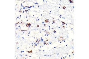 Immunohistochemistry (IHC) image for anti-Heme Oxygenase (Decycling) 1 (HMOX1) antibody (ABIN7267605)