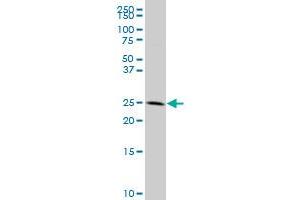 ITGB4BP polyclonal antibody (A01), Lot # 051122JC01 Western Blot analysis of ITGB4BP expression in HL-60 . (EIF6 antibody  (AA 146-245))