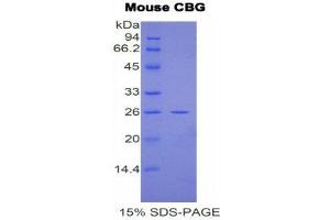 SDS-PAGE (SDS) image for serpin Peptidase Inhibitor, Clade A (Alpha-1 Antiproteinase, Antitrypsin), Member 6 (SERPINA6) (AA 57-256) protein (His tag) (ABIN1877442) (SERPINA6 Protein (AA 57-256) (His tag))