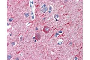 Immunohistochemistry (IHC) image for anti-alpha Tubulin (TUBA1) (Subunit alpha) antibody (ABIN960542)