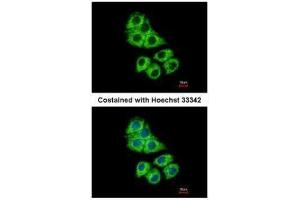 ICC/IF Image Immunofluorescence analysis of methanol-fixed Hep G2, using Coronin 1A, antibody at 1:500 dilution. (Coronin 1a antibody  (C-Term))