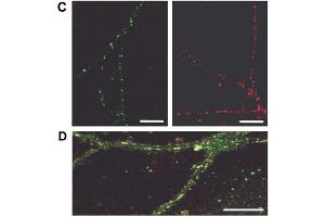 Fluorescence Microscopy (FM) image for Goat anti-Guinea Pig IgG (Heavy & Light Chain) antibody (Texas Red (TR)) - Preadsorbed (ABIN101285)