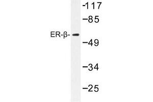 Image no. 1 for anti-Estrogen Receptor 2 (ESR2) antibody (ABIN272305) (ESR2 antibody)