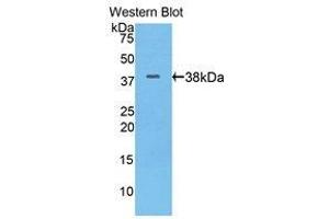 Western Blotting (WB) image for anti-Keratin 17 (KRT17) (AA 84-392) antibody (ABIN1175075)