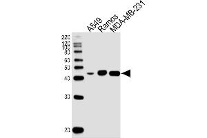 Lane 1: A549 Cell lysates, Lane 2: Ramos Cell lysates, Lane 3: MDA-MB-231 Cell lysates, probed with HLA-G (800CT6. (HLAG antibody)