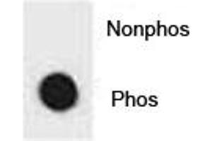 Dot blot analysis of phospho-IKK beta antibody.