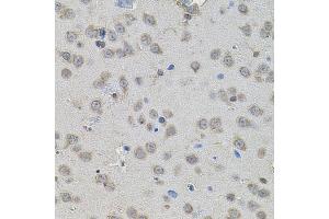 Immunohistochemistry of paraffin-embedded rat brain using PPARG antibody (ABIN5998576) at dilution of 1/100 (40x lens). (PPARG antibody)