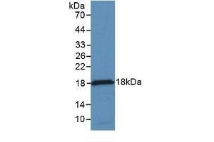 Detection of Recombinant MCP1, Rabbit using Monoclonal Antibody to Monocyte Chemotactic Protein 1 (MCP1) (CCL2 antibody  (AA 24-125))