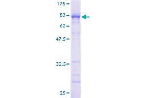 NUP62 Protein (AA 1-522) (GST tag)