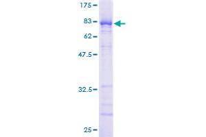 Image no. 1 for Nucleoporin 62kDa (NUP62) (AA 1-522) protein (GST tag) (ABIN1313238)